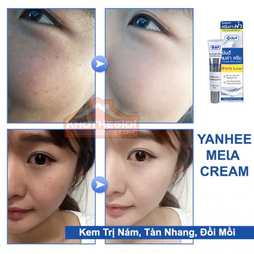 Kem trị nám, tàn nhang, đồi mồi Yanhee Mela Cream 20g Kem trị nám, tàn nhang, đồi mồi Yanhee Mela Cream 20g